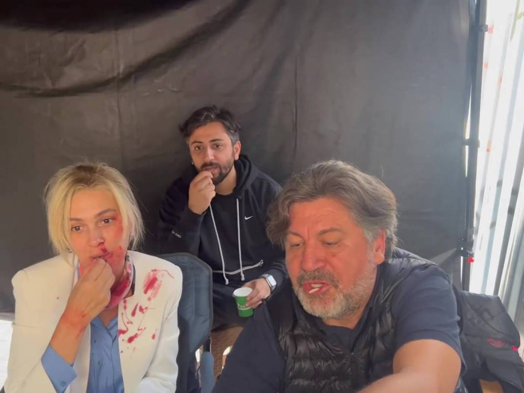 Bergüzar Korel'in kanlı paylaşımı takipçilerini korkuttu! Neden paylaştığı daha sonra ortaya çıktı 6